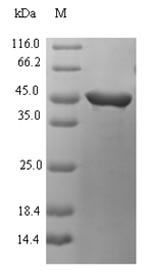 (Tris-Glycine gel) Discontinuous SDS-PAGE (reduced) with 5% enrichment gel and 15% separation gel.
